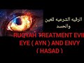 RUQYAH TREATMENT EVIL EYE ( AYN ) AND ENVY ( HASAD ).