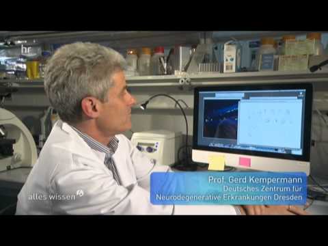 Bewegung fürs Gehirn - macht Sport wirklich schlau?