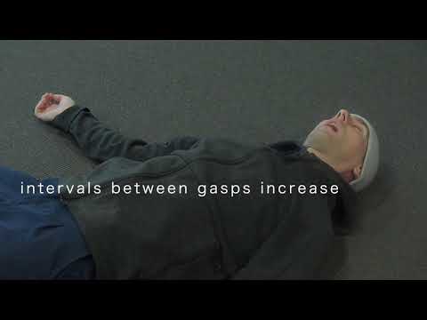 Agonal Breathing