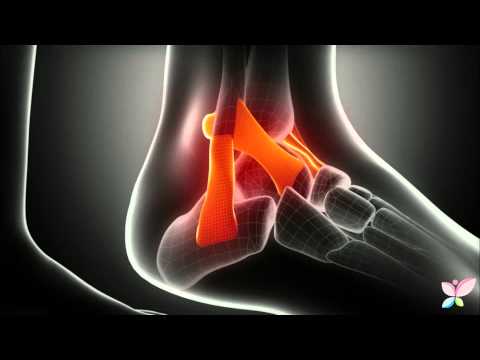 Ginnastica complesse di dolore lombare Vivere in modo sano sulla osteoartrite del ginocchio