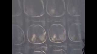 Surgical Radiology - X-ray exam