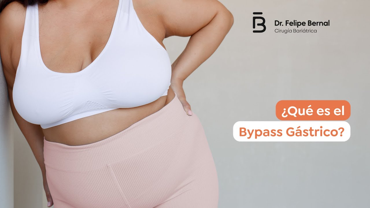 Bypass Gástrico: ¿El Método Definitivo contra la Obesidad? | Dr. Felipe Bernal, Experto en Bogotá