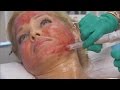 Former Baywatch Actress Donna D Errico Uses Blood For Extreme Beauty Regime