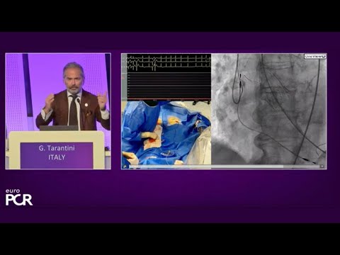 Redo-TAVI and patient pathway optimisation - EuroPCR 2023