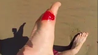 Stung by a Stingray LIVE on film!!