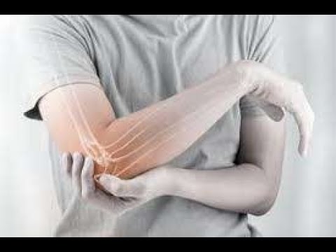 Artroza artrita articulațiilor mici ale picioarelor