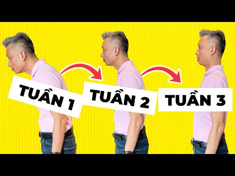 Chấm Dứt GÙ LƯNG TẠI NHÀ! 5 Bài Tập HIỆU QUẢ Giúp Bạn Đứng Thẳng Tức Thì