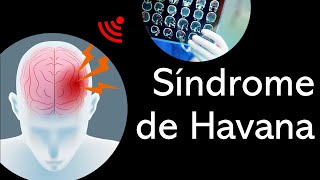 O que é síndrome de havana