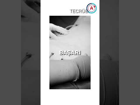 Plastic, Reconstructive, and Aesthetic Surgery Op. Dr. Sinem Sezer | A Plus Hospital