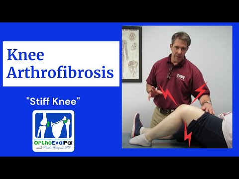 Quadriceps Repair 3 Weeks Post Op