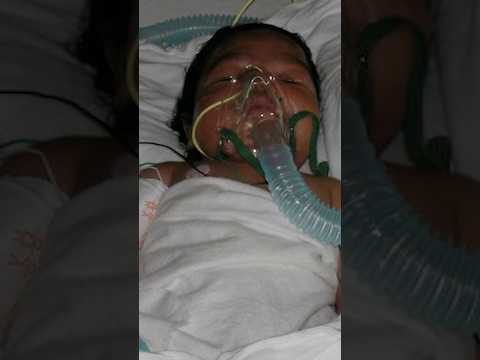 What does whooping cough sound like?