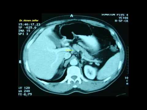 Anatomie de l'Abdomen en Coupes Axiales