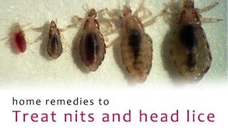 Home Remedies to treat Nits and Head Lice