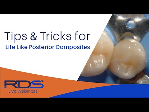 Tips And Tricks For Life Like Posterior Restorations