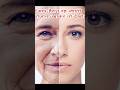 झुर्रियों से छुटकारा कैसे पाएं Wrinkles Kaise Ha