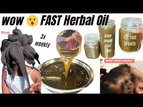 Wow 😮DIY FAST HAIR GROWTH OIL/ Grow Longer Hair 10x Faster in 2024.