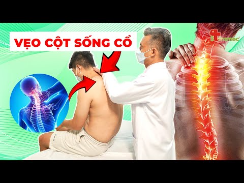 Đừng Để Cơn Đau Cổ, Lưng, Vai Ám Ảnh Cuộc Sống Bạn! Giải Pháp Ngay Tại Đây!