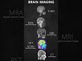 Brain Imaging Xray MRA CT Scan PET Scan MRI Brain Medical Xray