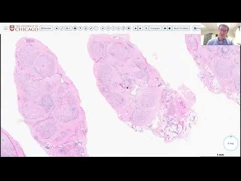 AANP Teaching Rounds - October 22, 2025 - Peripheral Nerve Biopsies