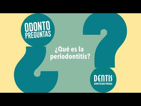 Odontopreguntas: ¿Qué es la periodontitis?