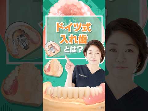 ドイツ式入れ歯とは？