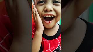 Download lagu Deffan's lips are bleeding 😱 #shorts mp3 Download lagu Deffan's lips are bleeding 😱 #shorts mp3