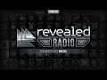 Revealed Radio 032 - Hosted by Maddix 