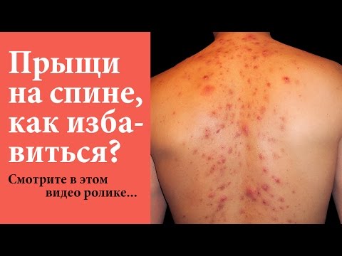 Остеохондроз можно ли ходить на физкультуру Мышечный спазм шейного и грудного отделов позвоночника