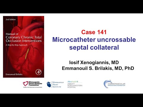 Case 141: Manual of CTO PCI - Microcatheter uncrossable septal collateral