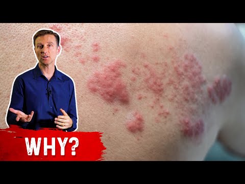 What are Enzymes and How do They Work Dr Berg