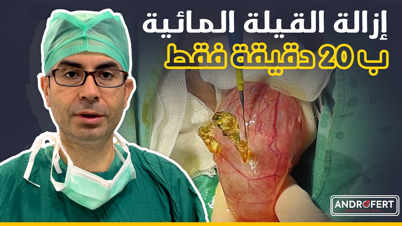 عملية القيلة المائية أو التجمع المائي في الخصية (Hydrocele)