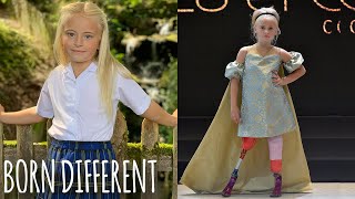 Double Amputee Slays New York & Paris Fashion Weeks | BORN DIFFERENT