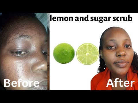 LEMON AND SUGAR FACE SCRUB BEFORE AND AFTER