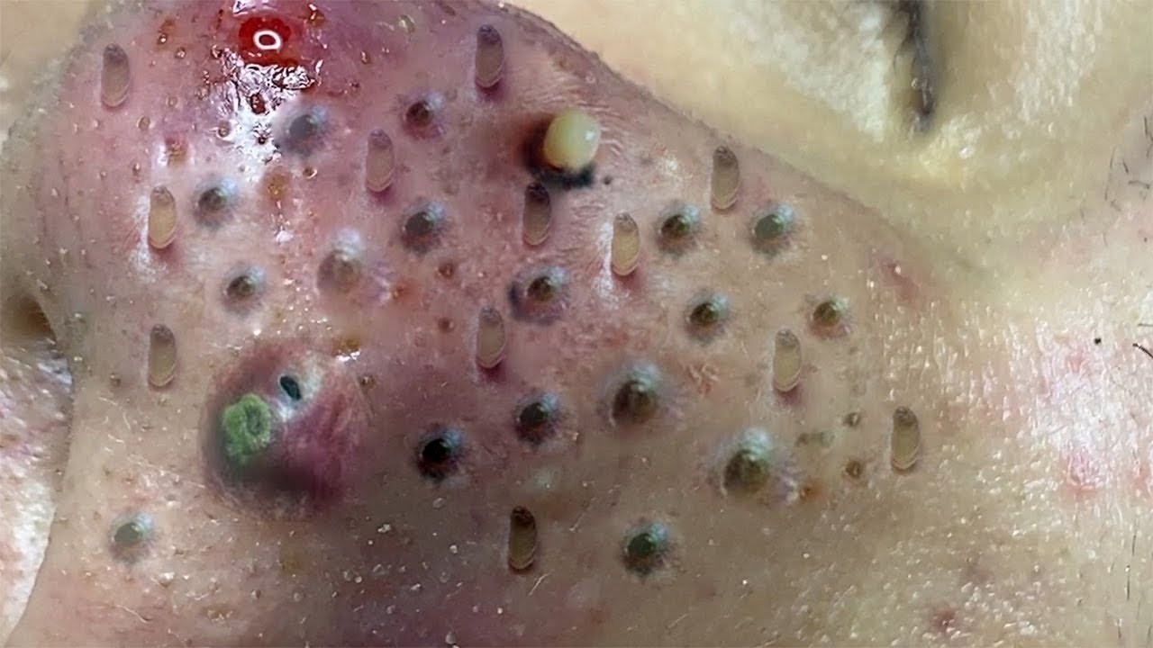 𝑺𝒐𝒐𝒕𝒉𝒊𝒏𝒈 𝑭𝒂𝒄𝒊𝒂𝒍 𝑻𝒓𝒆𝒂𝒕𝒎𝒆𝒏𝒕 𝑭𝒐𝒓 𝑺𝒕𝒓𝒆𝒔𝒔 𝑹𝒆𝒍𝒊𝒆𝒇 𝒂𝒕 𝑳𝒖𝒙𝒖𝒓𝒚 𝑺𝒑𝒂 𝑨𝒄𝒉𝒊𝒆𝒗𝒆 𝑰𝒏𝒏𝒆𝒓 𝑷𝒆𝒂𝒄𝒆 #501012