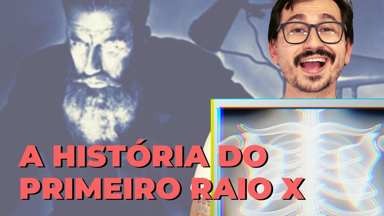 A HISTÓRIA DO PRIMEIRO RAIO X || VOGALIZANDO A HISTÓRIA