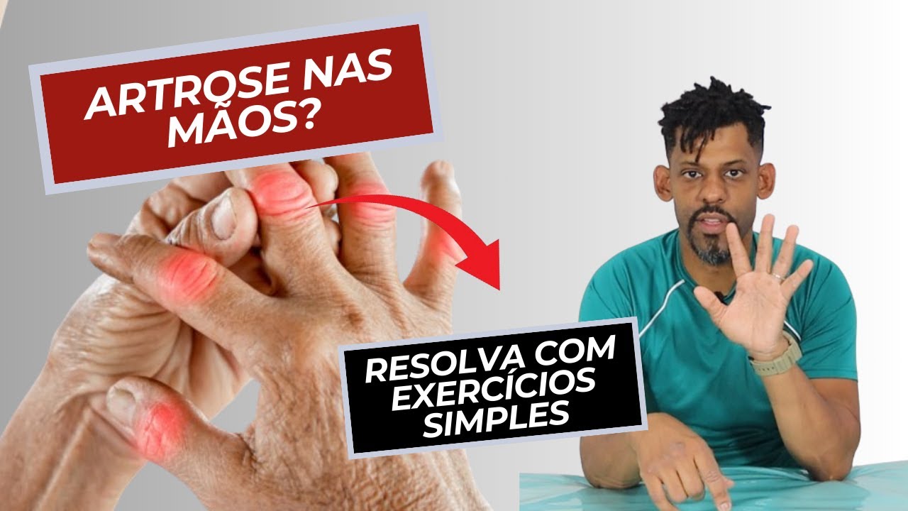 Os Melhores Exercícios para Aliviar a Artrose nas Mãos