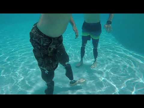 Dream Team Prosthetics presents Genium X3 Waterproof Knee