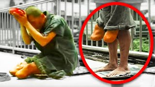 Fake Disabled Beggars Exposed