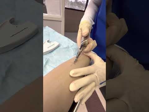 Stapler / Laceration