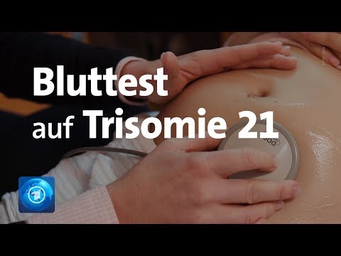 Sollen Krankenkassen den Test auf Trisomie 21 zahlen?