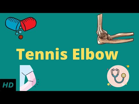 Tennis elbow, Causes, Signs and Symptoms, Diagnosis and Treatment.