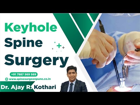 Patient Testimonials | Dr. Ajay Kothari - Spine Surgeon | Shivaji Nagar, Pune