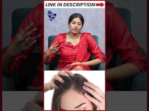 பொடுகு சரியாக இத பண்ணுங்க! - நச்சுனு 4 tips - Watch Till End