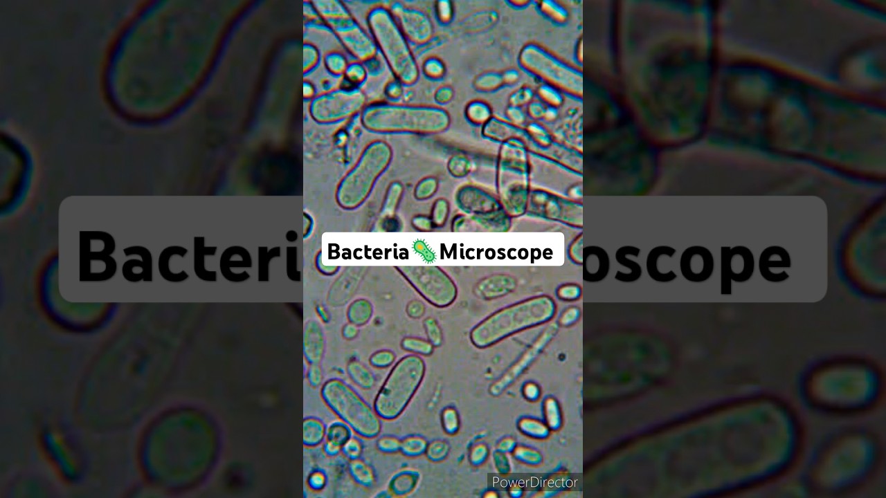 Bacteria Under Microscope How does bacteria look under Microscope