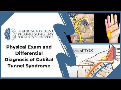 Physical Exam and Differential Diagnosis of Cubital Tunnel Syndrome