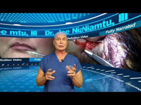 download lagu mp3 mp4 Sliding Genioplasty Cost, download lagu Sliding Genioplasty Cost gratis, unduh video klip Sliding Genioplasty Cost