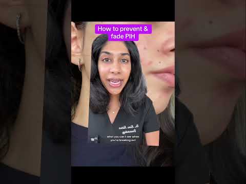 Post acne mark tips from a dermatologist #hyperpigmentation #skincare
