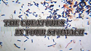 The Creatures In Your Stomach
