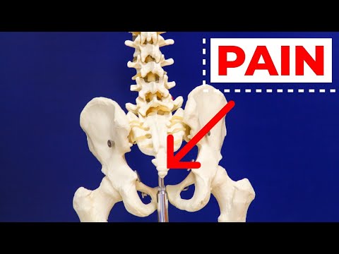 #1 Treatment for Tail Bone or Sits Bone Pain GIVEAWAY!