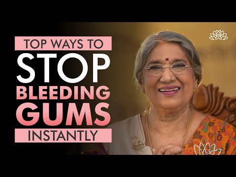Bleeding Gums? Causes and Treatment of Bleeding Gums at Home | Teeth Health Tips